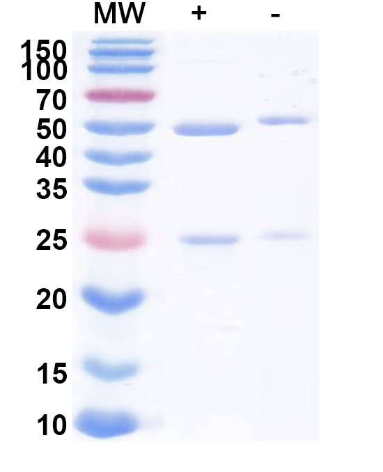 Endo S2酶活验证电泳图